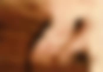 Man with spot (preview)