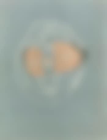 Untitled (preview)