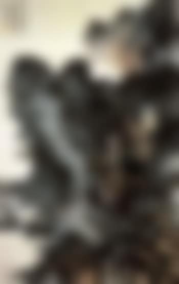 High cataract (preview)