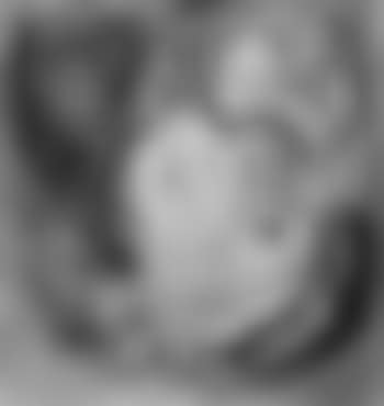 Le chou (preview)