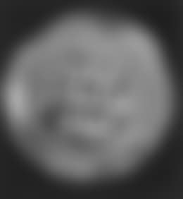 Bouche-Evier (preview)