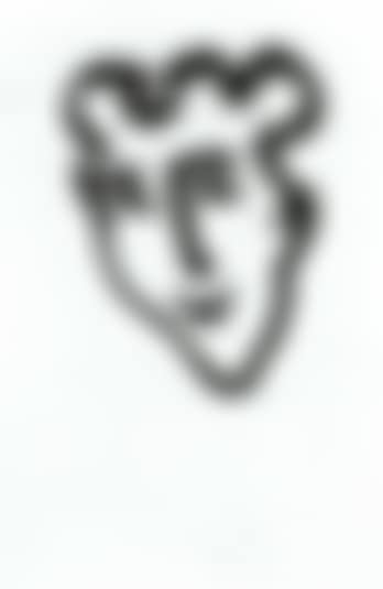 Masque aigu (preview)