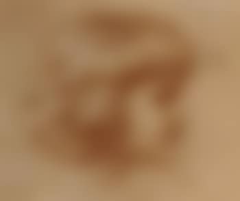 Head of child (preview)