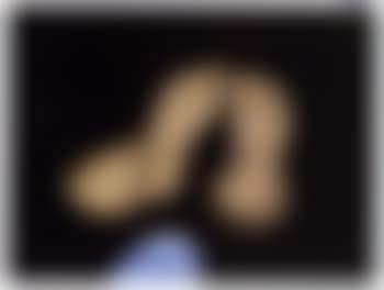 Pieds (preview)