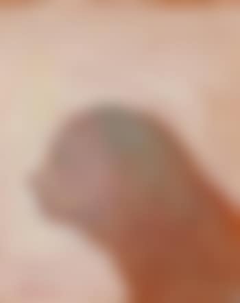 Head (preview)