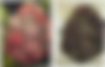 Second Series Biopsy: M122/376, M122/377 (preview)
