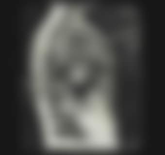 X-Ray Telephone (preview)