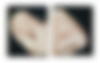 Ear and Nose: Right Side (Analia) (preview)