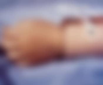 Morgue death pnemonia due to drowning II (preview)
