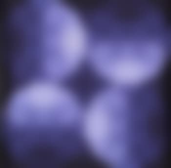 Structure ambigüe RBV (preview)