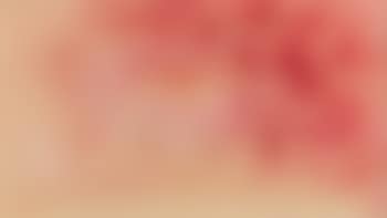 Sans titre (preview)