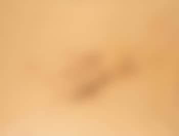 Sans titre (preview)