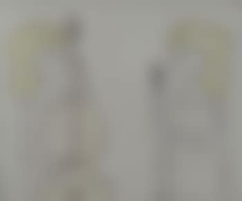 Concertino (preview)
