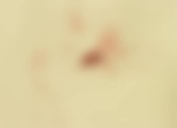 O. T. (Geisyr, Nymphe und blutender Riesenhirsch) (preview)