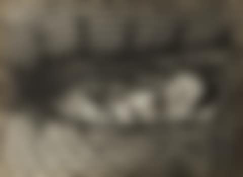 Natterkopf (preview)