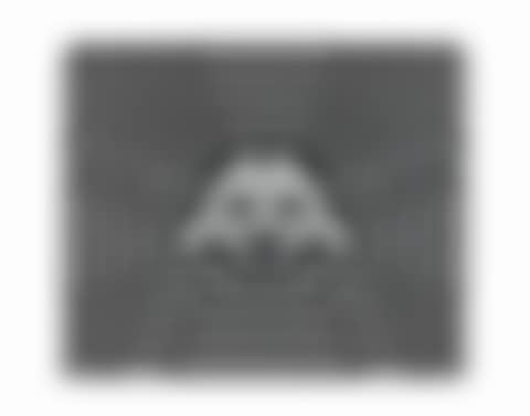 Retinal invasion (preview)