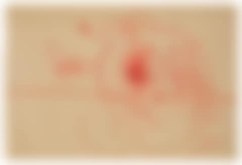 UNTITLED (preview)