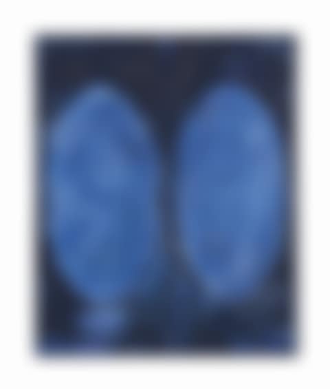 Bleu au double ovale (preview)