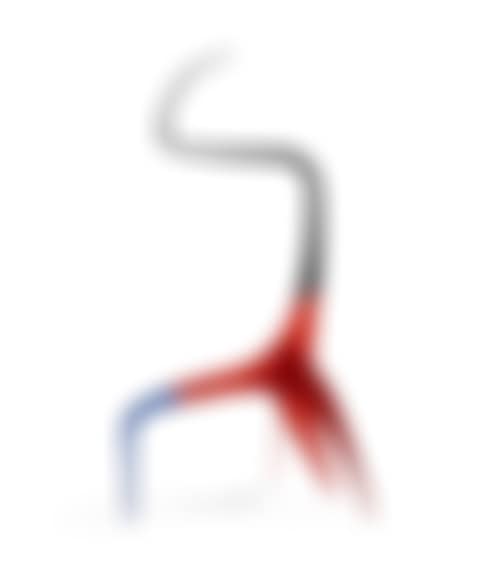 Uprooted Whip (preview)