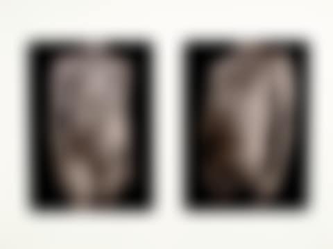 Untitled, from Doctors of the World portfolio (preview)