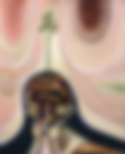 Untitled (preview)