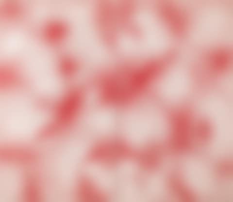 Skin (preview)