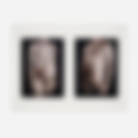 Untitled diptych (from the Doctors of the World portfolio) (preview)
