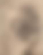 Study after academic plaster (preview)