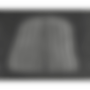 Pumpkin (White Y) (Kusama 150) (preview)